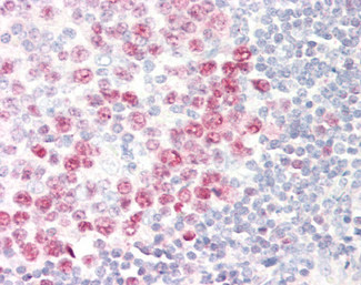 DUT Antibody in Immunohistochemistry (Paraffin) (IHC (P))