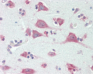 ENDOGL1 Antibody in Immunohistochemistry (Paraffin) (IHC (P))