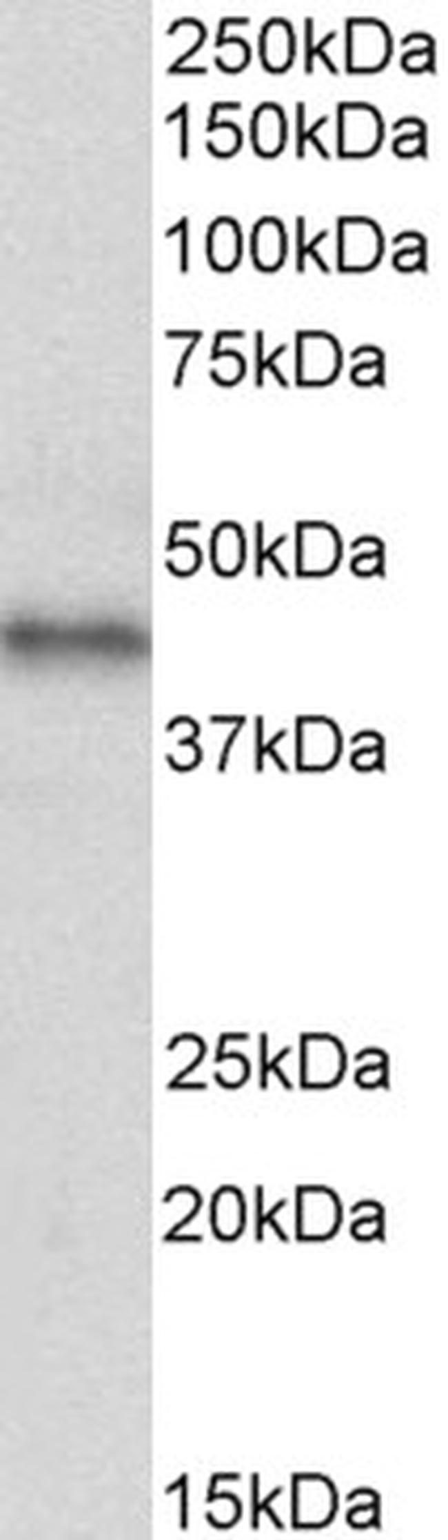 CXCR7 Antibody in Western Blot (WB)