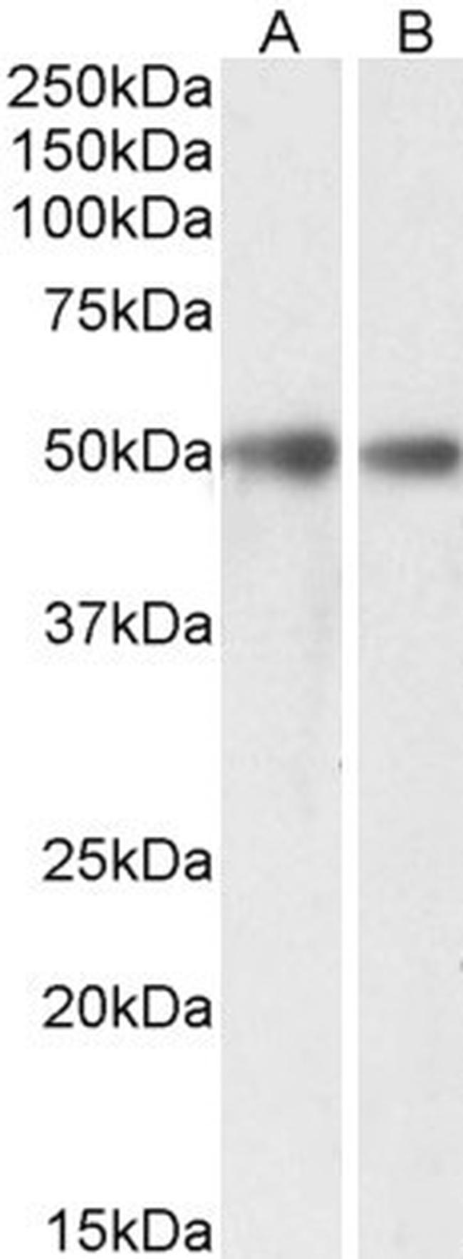 GDE1 Antibody in Western Blot (WB)