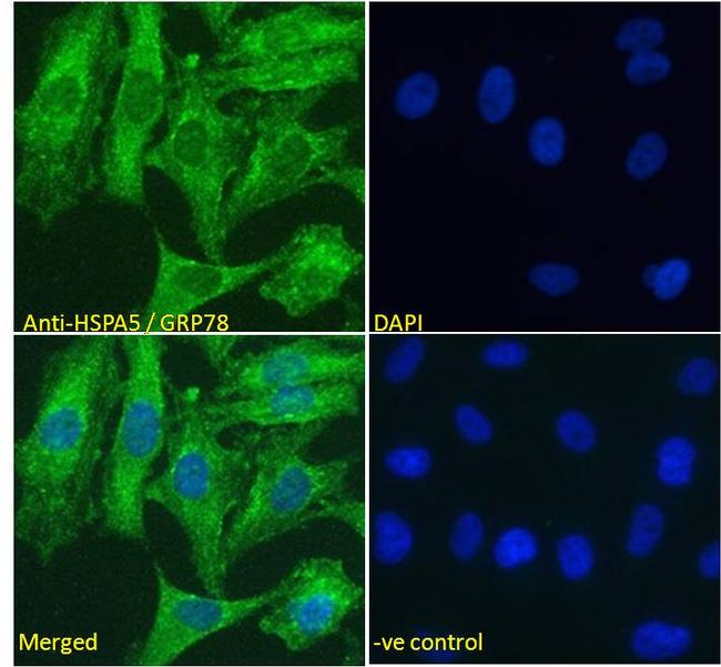 GRP78 Antibody in Immunocytochemistry (ICC/IF)