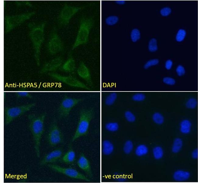 GRP78 Antibody in Immunocytochemistry (ICC/IF)