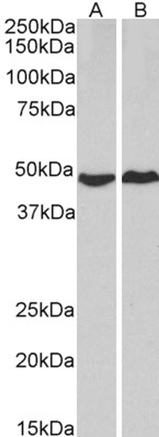 PKA alpha Antibody in Western Blot (WB)