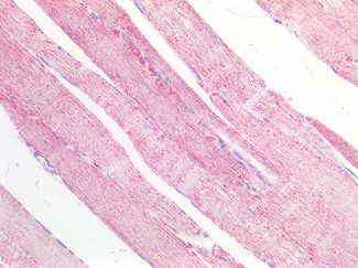 MDH2 Antibody in Immunohistochemistry (Paraffin) (IHC (P))