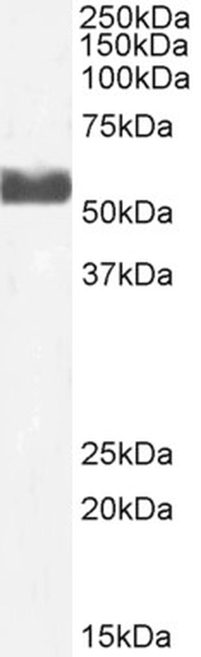 CYP2D6 Antibody in Western Blot (WB)