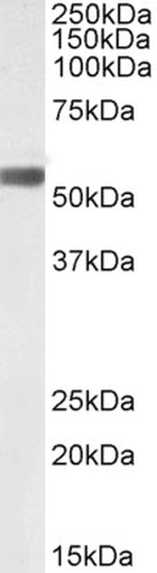 LAP (Latency Associated Peptide) Antibody in Western Blot (WB)