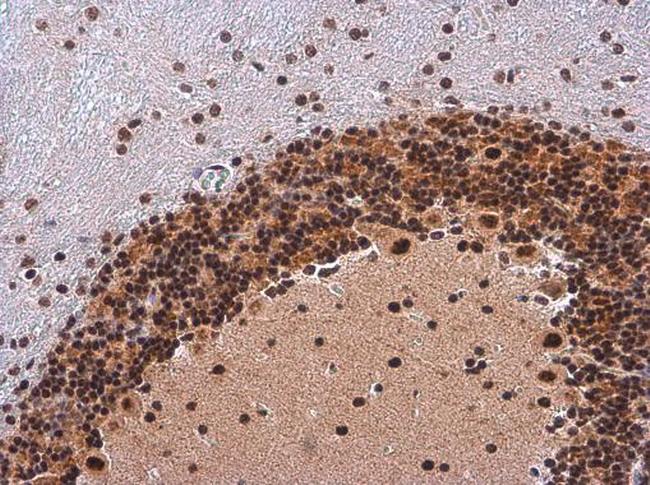 Phospho-IRS1 (Ser307) Antibody in Immunohistochemistry (Paraffin) (IHC (P))