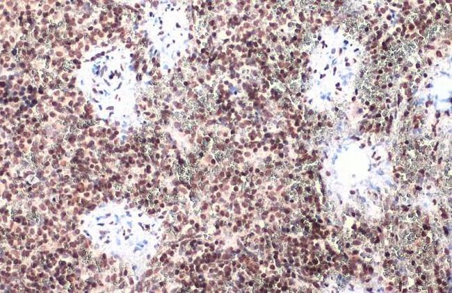 Phospho-IRF3 (Ser396) Antibody in Immunohistochemistry (Paraffin) (IHC (P))