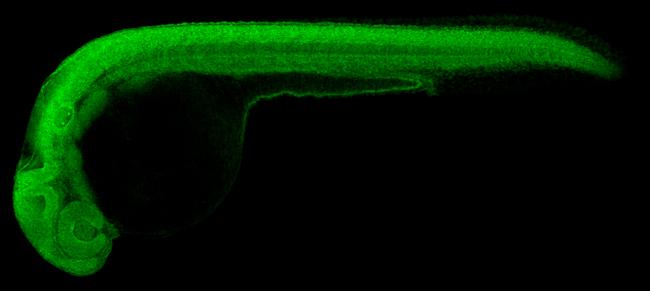 GLI2 Antibody in Immunohistochemistry (PFA fixed) (IHC (PFA))