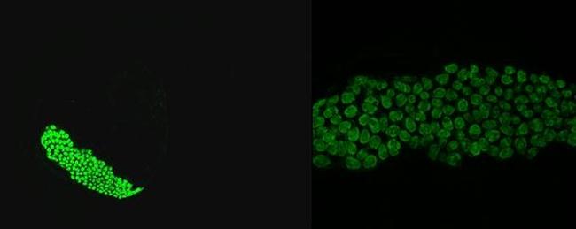 Cathepsin Lb Antibody in Immunohistochemistry (PFA fixed) (IHC (PFA))