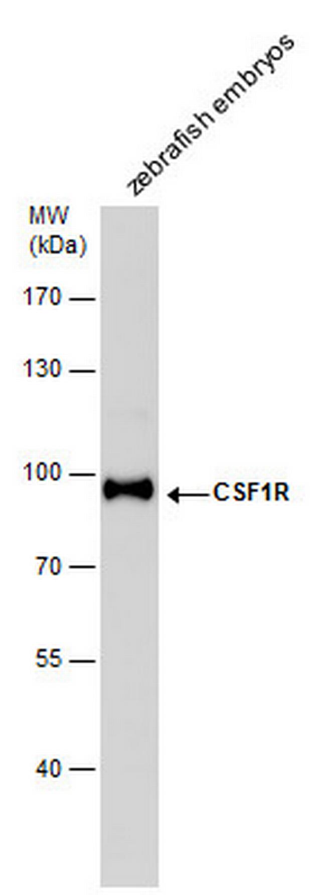 CSF1R Antibody in Western Blot (WB)