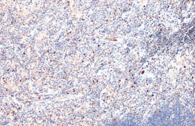 EOMES Antibody in Immunohistochemistry (Paraffin) (IHC (P))