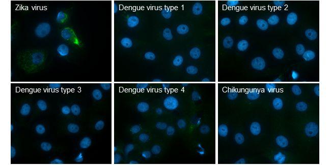 Zika Virus prM (strain H/PF/2013) Antibody in Immunocytochemistry (ICC/IF)