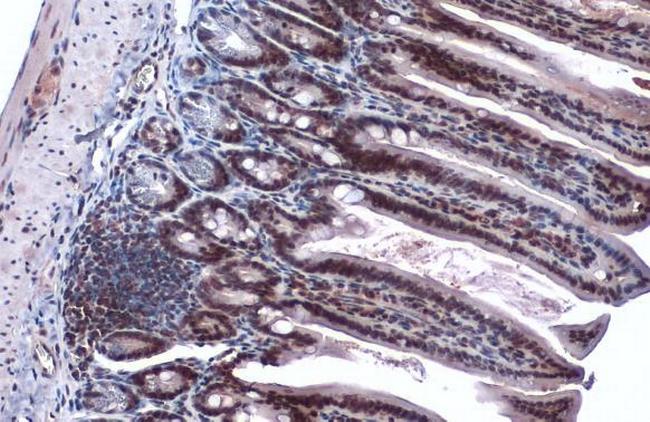 p300 Antibody in Immunohistochemistry (Paraffin) (IHC (P))