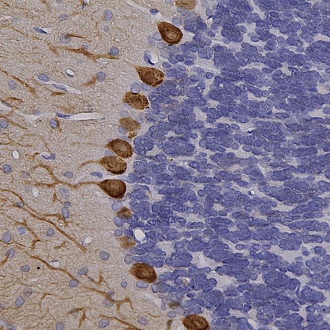 Calbindin D28K Antibody in Immunohistochemistry (Paraffin) (IHC (P))