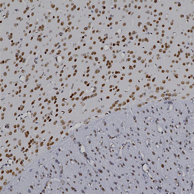 MECP2 Antibody in Immunohistochemistry (Paraffin) (IHC (P))