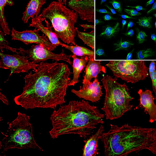 Vimentin Antibody in Immunocytochemistry (ICC/IF)