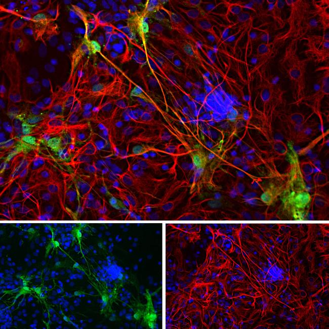 Galectin 3 Antibody in Immunocytochemistry (ICC/IF)