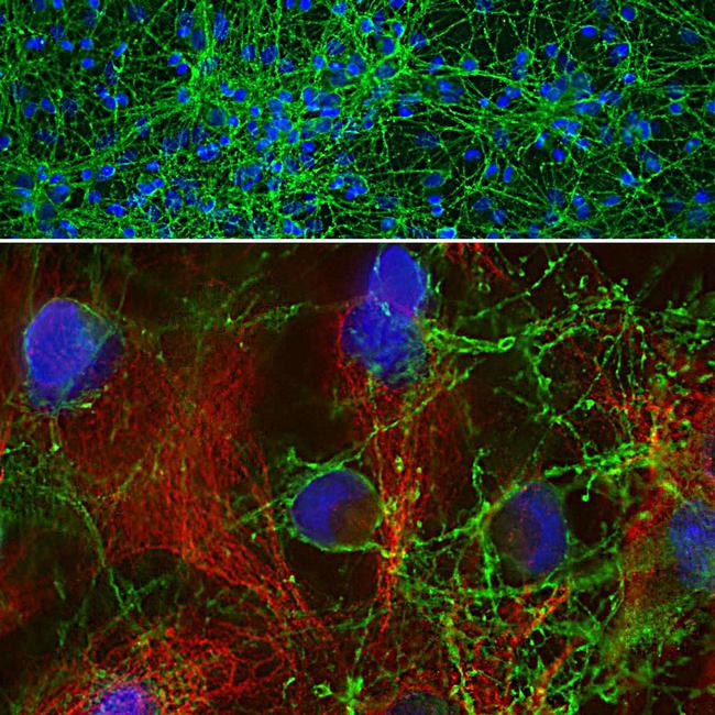 GAP43 Antibody in Immunocytochemistry (ICC/IF)