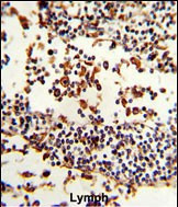 IGHA1 Antibody in Immunohistochemistry (Paraffin) (IHC (P))