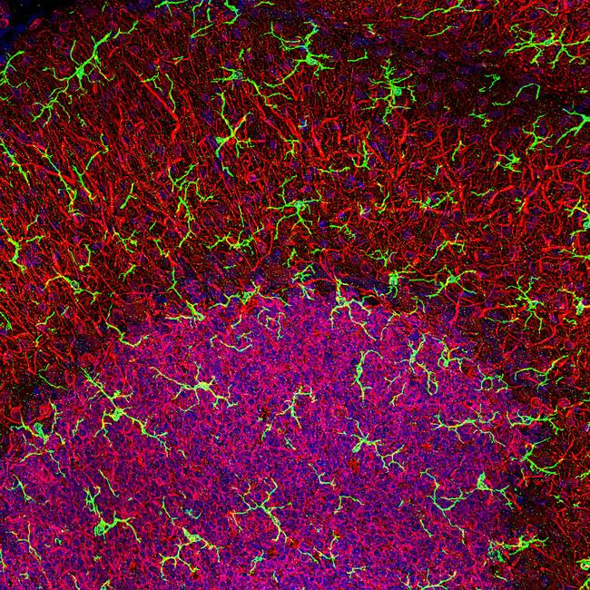 IBA1 Antibody in Immunohistochemistry (Paraffin) (IHC (P))