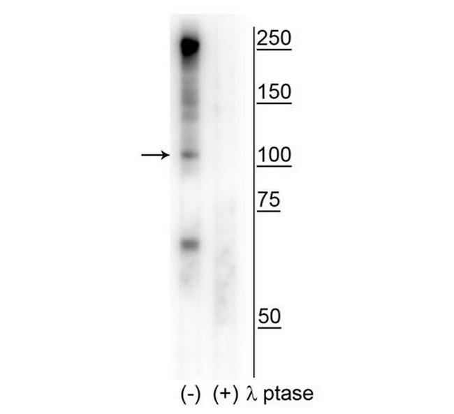 Phospho-CtIP (Ser327) Antibody in Western Blot (WB)