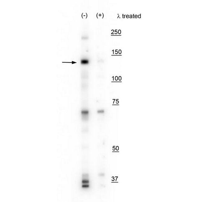 Phospho-IRE1 alpha (Ser724) Antibody in Western Blot (WB)