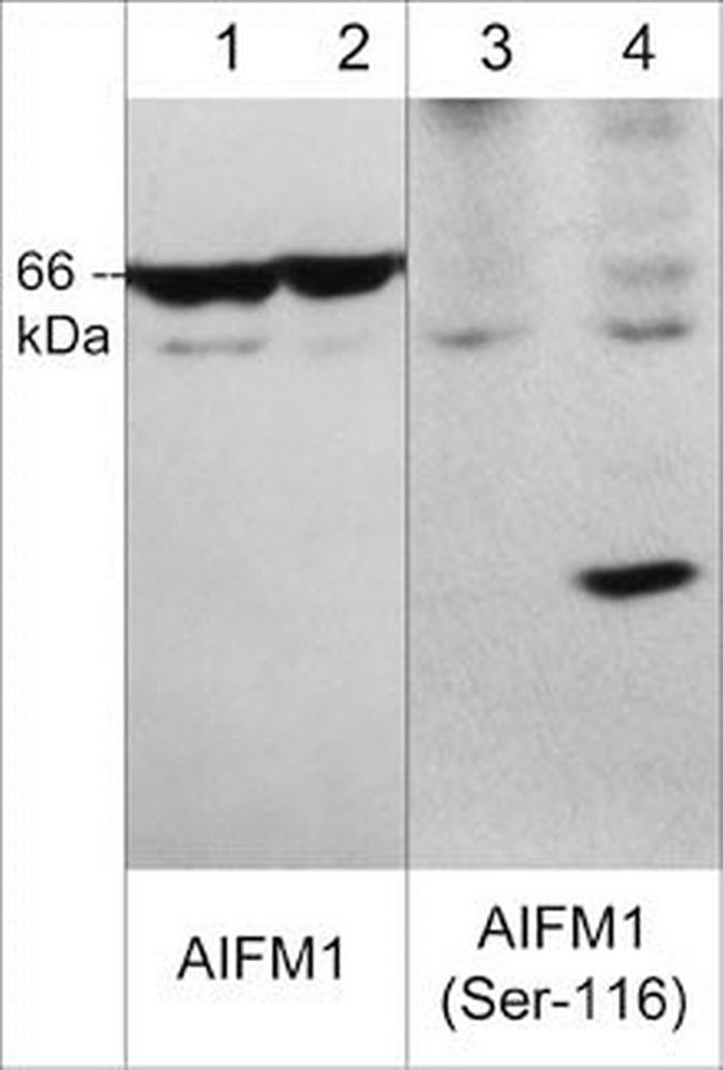 Phospho-AIF (Ser116) Antibody in Western Blot (WB)