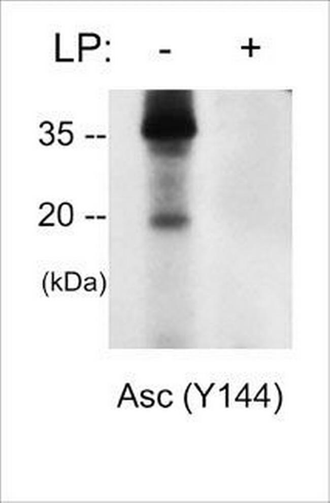 Phospho-PYCARD (Tyr144) Antibody in Western Blot (WB)