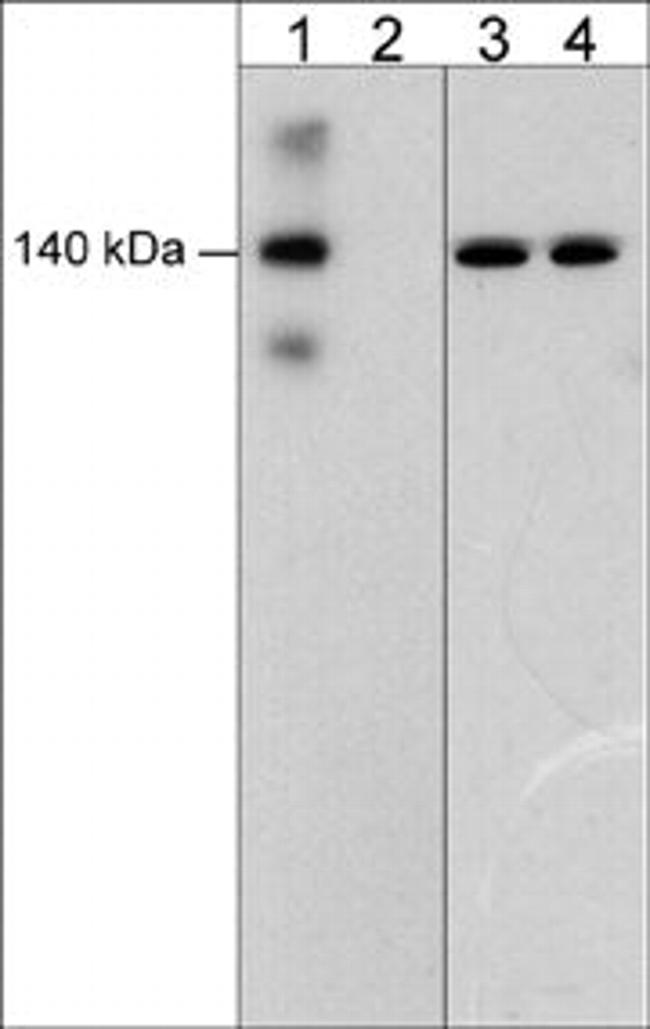 Phospho-VE-cadherin (Tyr685) Antibody in Western Blot (WB)