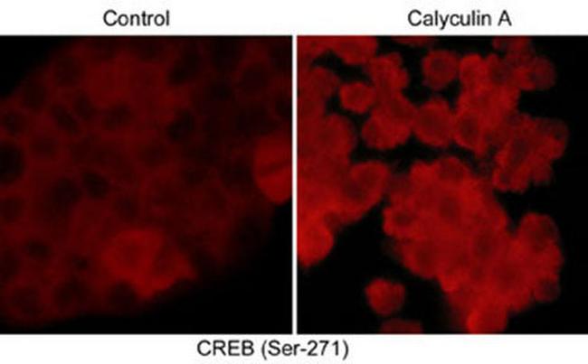 Phospho-CREB (Ser271) Antibody in Immunocytochemistry (ICC/IF)