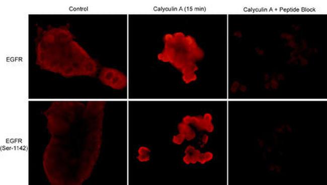 Phospho-EGFR (Ser1142) Antibody in Immunocytochemistry (ICC/IF)