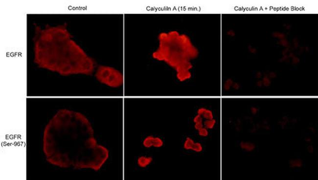 Phospho-EGFR (Ser967) Antibody in Immunocytochemistry (ICC/IF)