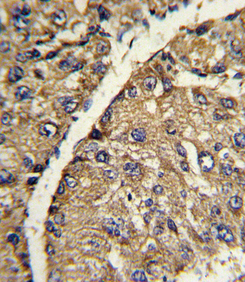 Vitronectin Antibody in Immunohistochemistry (Paraffin) (IHC (P))