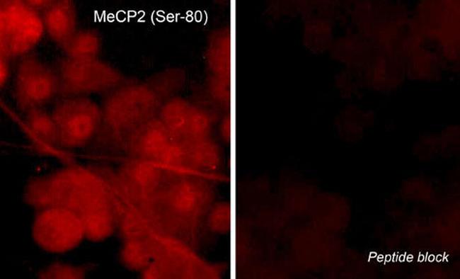 Phospho-MECP2 (Ser80) Antibody in Immunocytochemistry (ICC/IF)