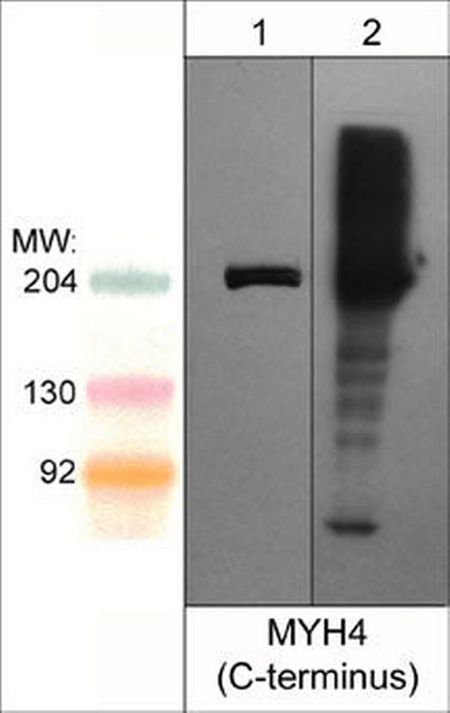 Myosin 4 Antibody in Western Blot (WB)