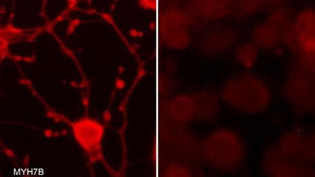 MYH7B Antibody in Immunocytochemistry (ICC/IF)