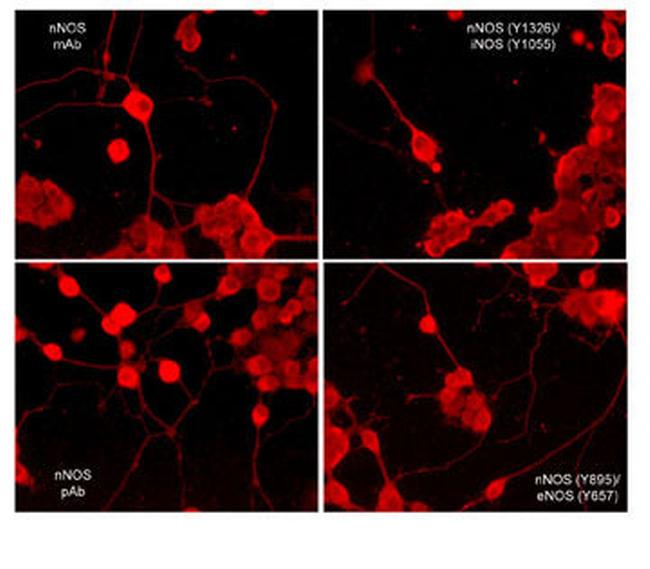 Phospho-iNOS (Tyr1055) Antibody in Immunocytochemistry (ICC/IF)