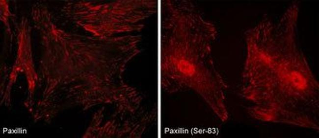 Phospho-Paxillin (Ser83) Antibody in Immunocytochemistry (ICC/IF)