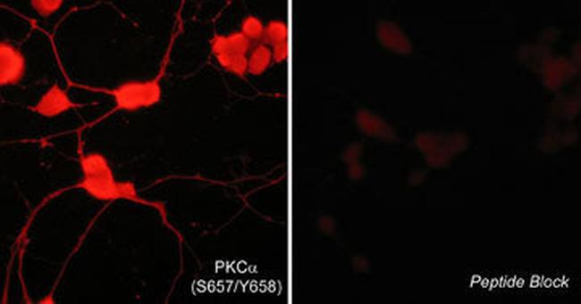 Phospho-PKC alpha (Ser657, Tyr658) Antibody in Immunocytochemistry (ICC/IF)