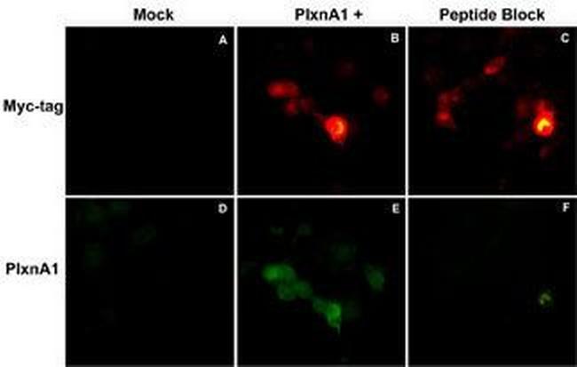 Plexin-A1 Antibody in Immunocytochemistry (ICC/IF)