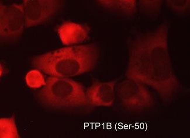 Phospho-PTP1B (Ser50) Antibody in Immunocytochemistry (ICC/IF)