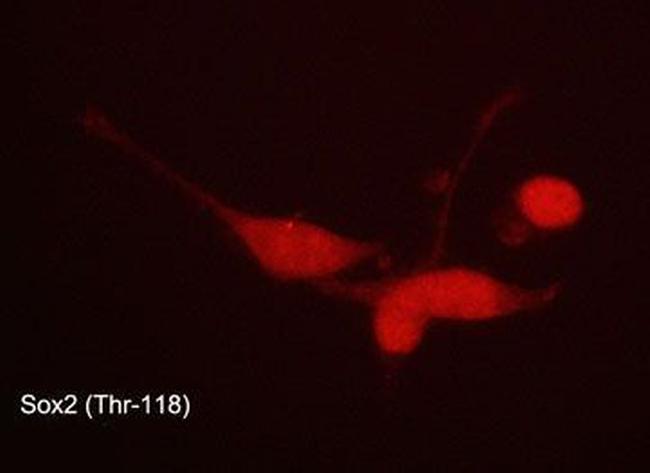 Phospho-SOX2 (Thr118) Antibody in Immunocytochemistry (ICC/IF)