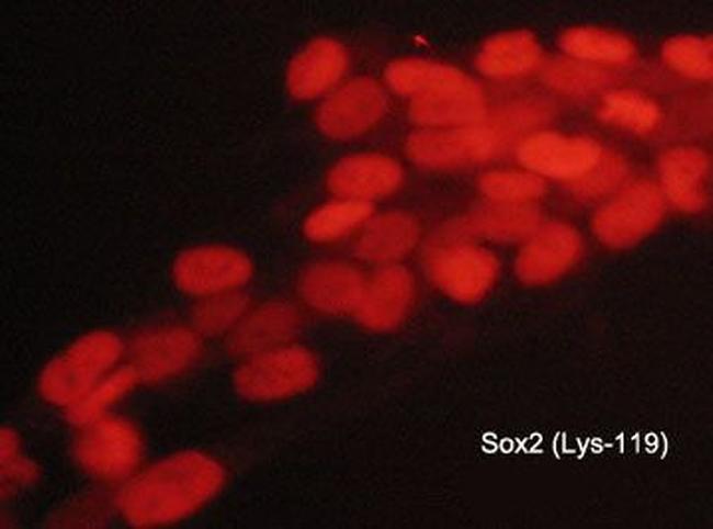 Methyl-SOX2 (Lys119) Antibody in Immunocytochemistry (ICC/IF)