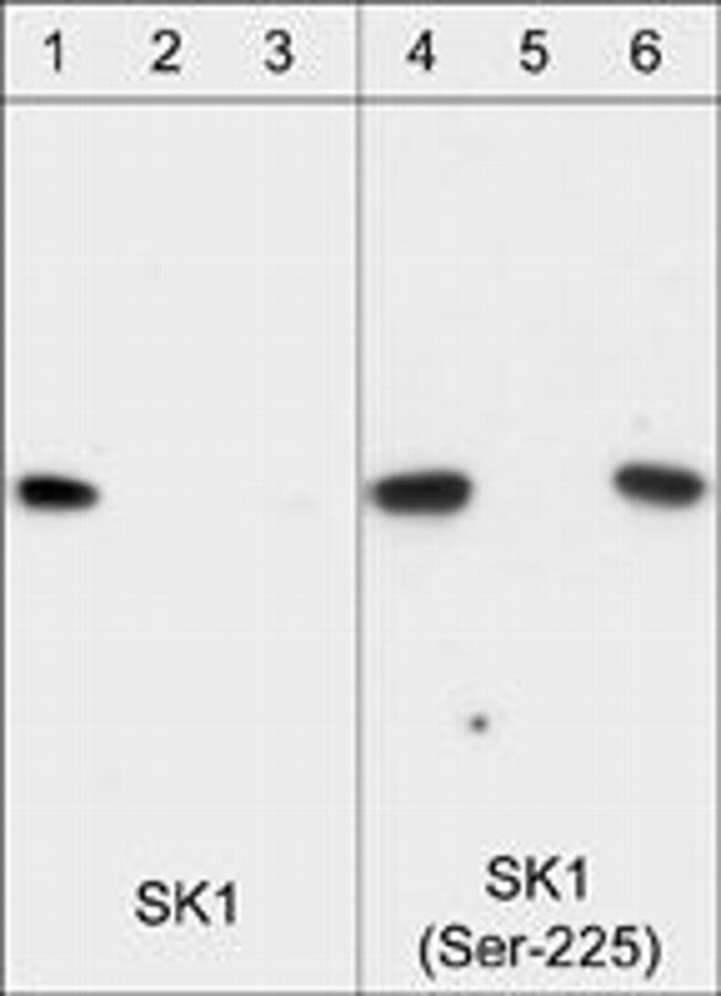 Phospho-SPHK1 (Ser225) Antibody in Western Blot (WB)