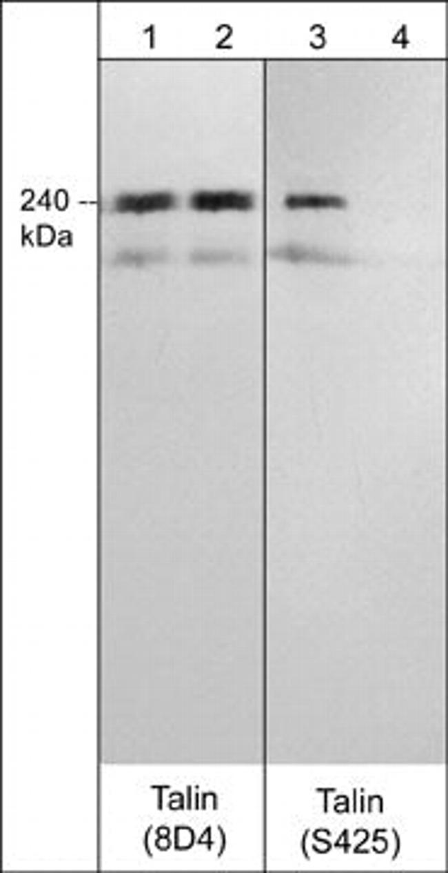 Phospho-Talin (Ser425) Antibody in Western Blot (WB)