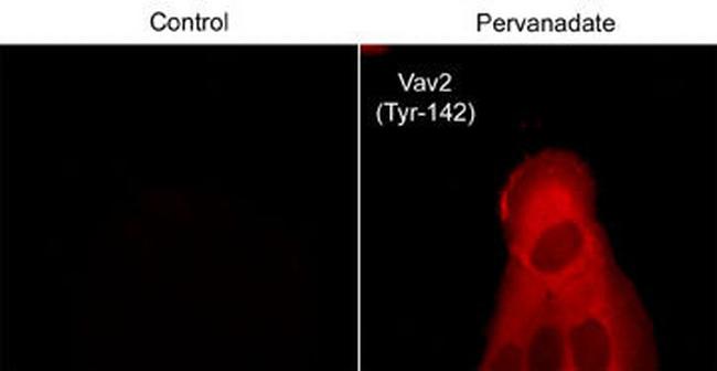 Phospho-VAV2 (Tyr142) Antibody in Immunocytochemistry (ICC/IF)