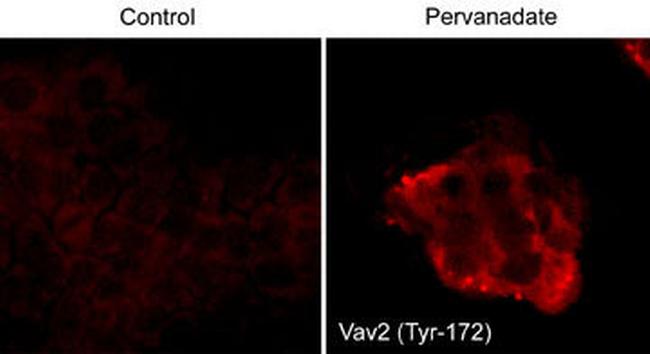 Phospho-VAV2 (Tyr172) Antibody in Immunocytochemistry (ICC/IF)