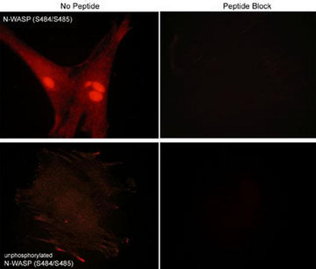 Phospho-N-WASP (Ser484, Ser485) Antibody in Immunocytochemistry (ICC/IF)