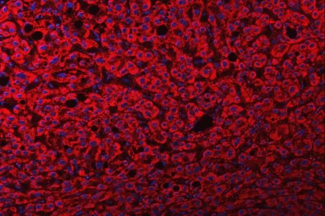 FRY Antibody in Immunohistochemistry (Paraffin) (IHC (P))